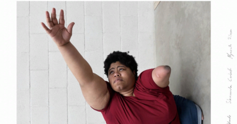 Художница с ограниченными возможностями снялась для новой коллекции JW Anderson