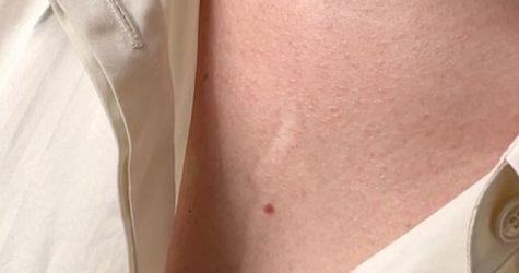 Ресейл-платформа The Cultt представила видеопроект о восприятии шрамов и дефектов