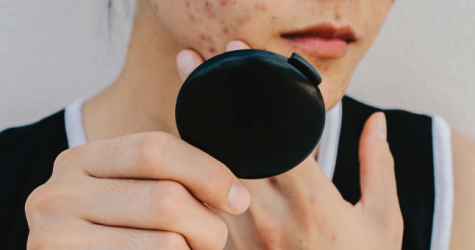 Google работает над приложением, которое будет диагностировать кожные заболевания