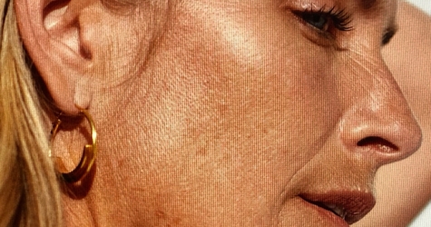 Что такое естественное омоложение в 2019 году