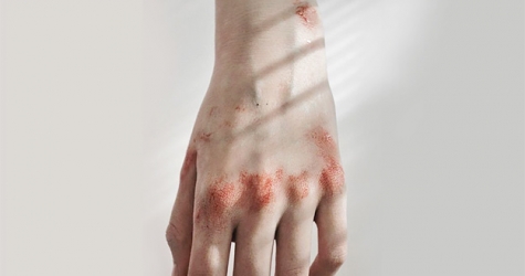 Госдума отменила уголовное наказание за побои в семье