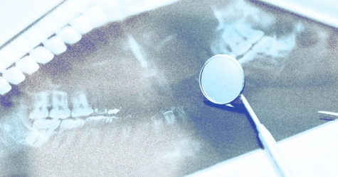 Я только спросить: как работает лазерное лечение десен и почему стоит выбрать именно его?