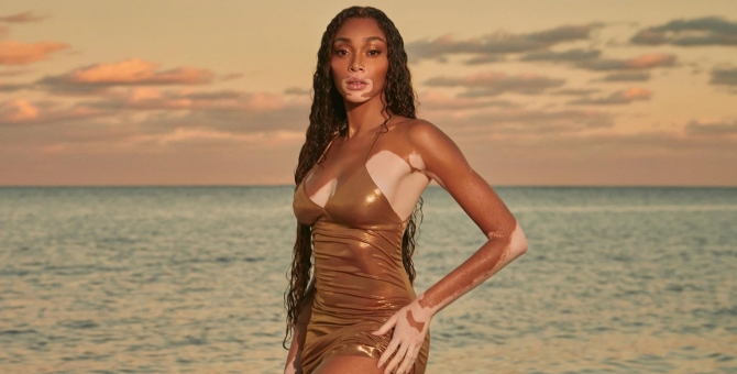 В The Sims 4 можно будет создавать персонажей с витилиго