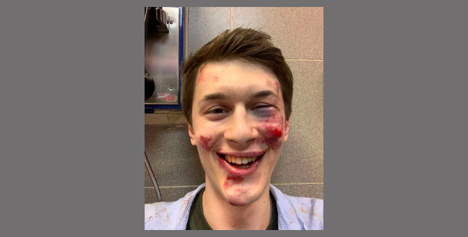 В Москве был избит ведущий «Эха Москвы» Егор Жуков