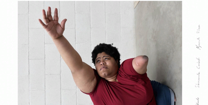 Художница с ограниченными возможностями снялась для новой коллекции JW Anderson