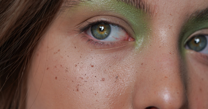 Микроигольчатый лифтинг: ответы на частые вопросы