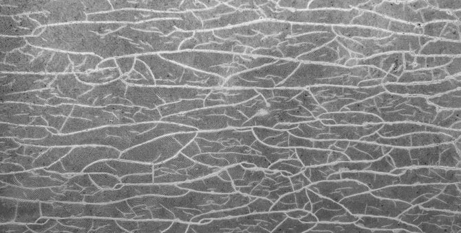 Как формируется целлюлит и почему кремы не работают