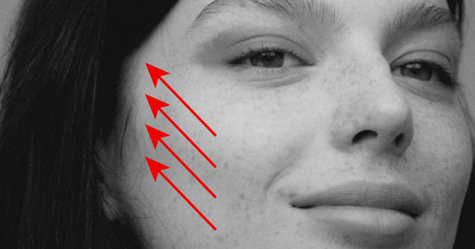 Мнение эксперта о популярной процедуре — Ulthera-терапия