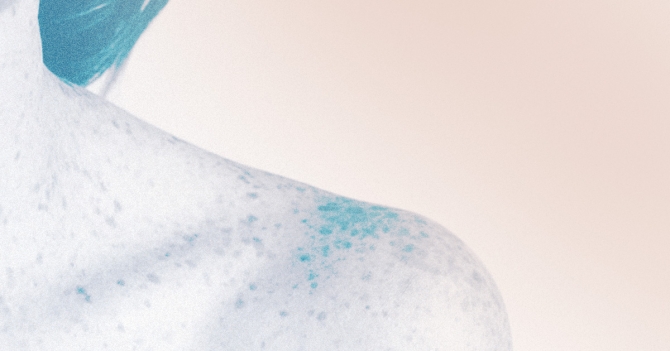 Диагностика меланомы: что нужно знать о родинках и когда стоит обратиться к врачу? Отвечает эксперт