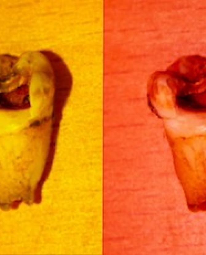 Зуб Джона Леннона уйдет с молотка