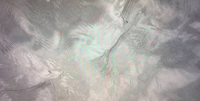 Как избавиться от утренней отечности лица