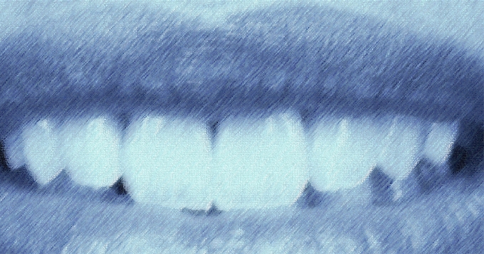 Я только спросить: что такое бруксизм и как перестать скрежетать зубами?